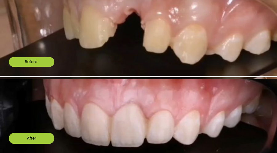 Transformation image