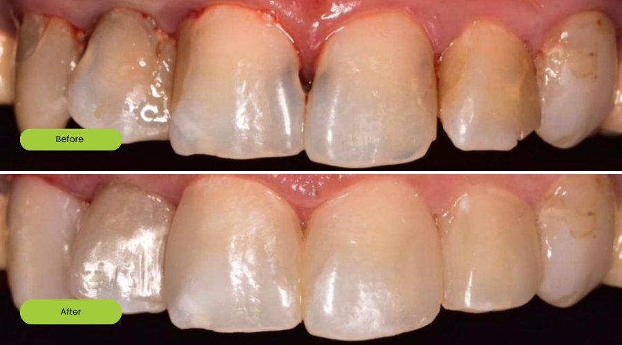 Transformation image