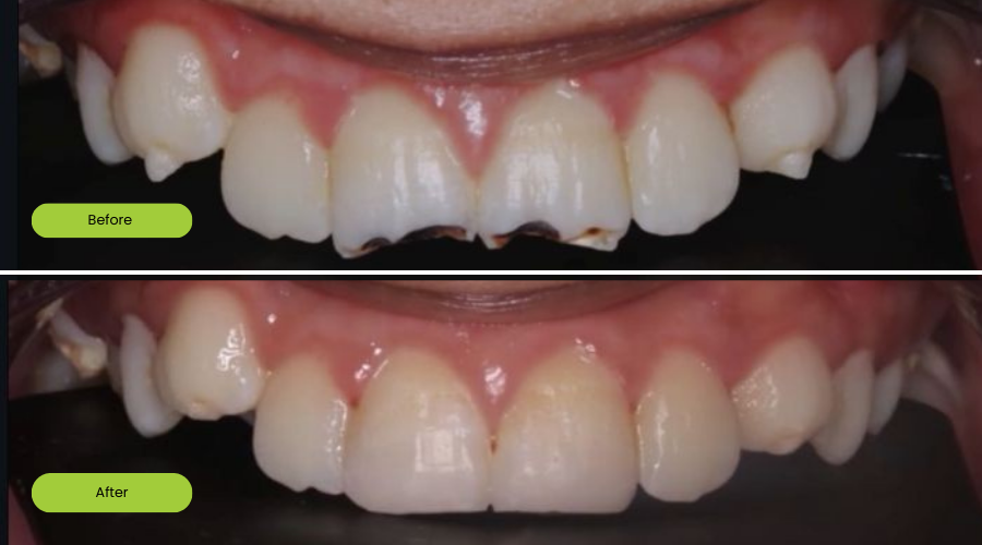 Transformation image