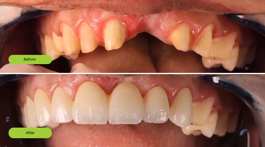 Transformation image