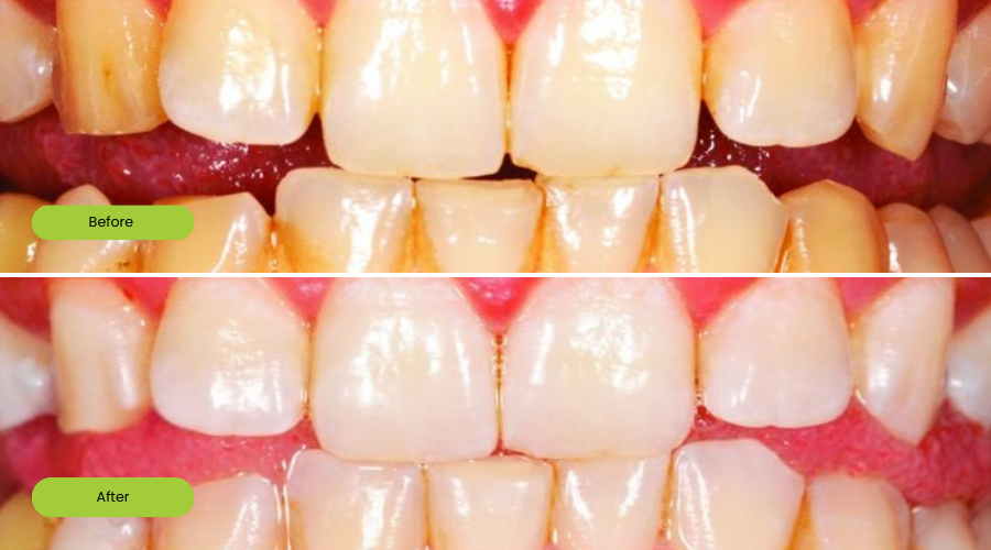 Transformation image