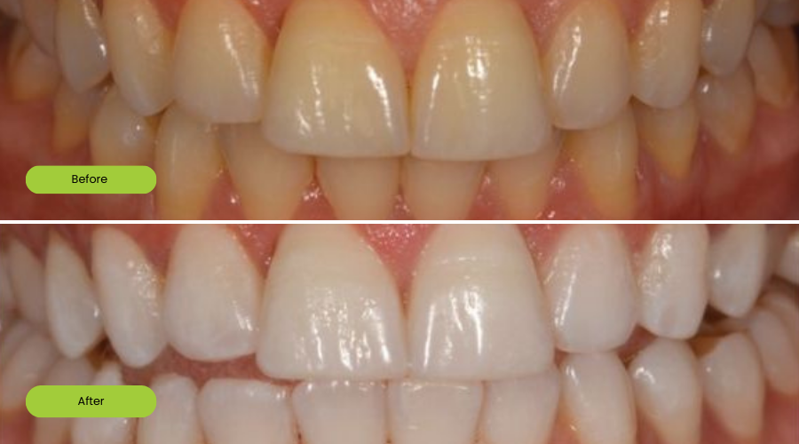 Transformation image